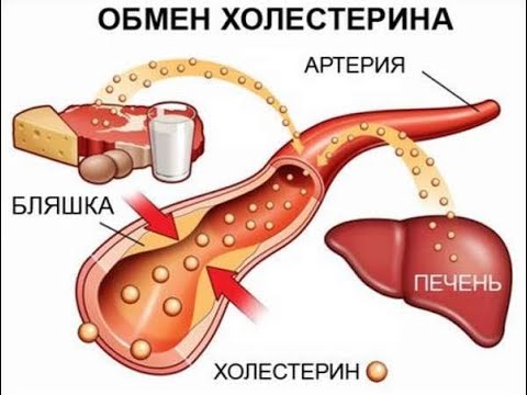 Как можно без медикаментов снизить холестерин. Galina Herdt