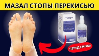 Перекись на стопы - что случилось после двух применений Потрясающие изменения