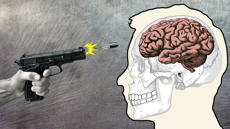 Anatomy of a