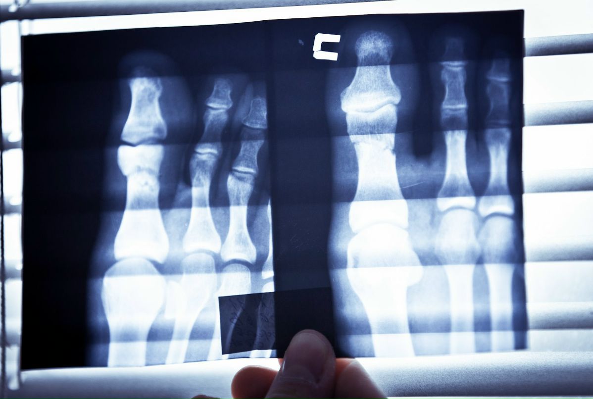 Jonny Symmetry | Warszawa