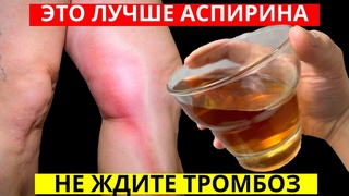 ПЕЙ Вместо Аспирина! Моментально Растворяет Тромбы в Сосудах и Лечит Вены при Тромбозе и Варикозе!