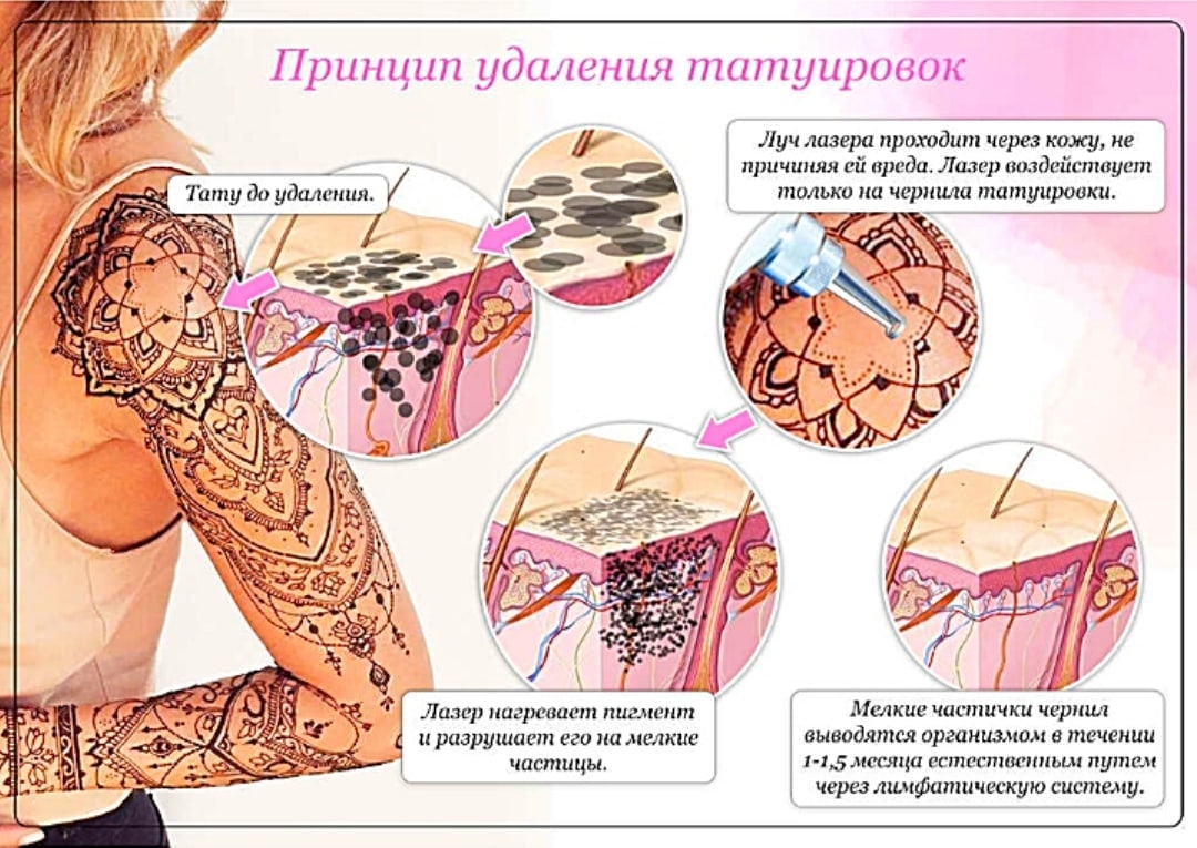 Процесс сведения Татуировки